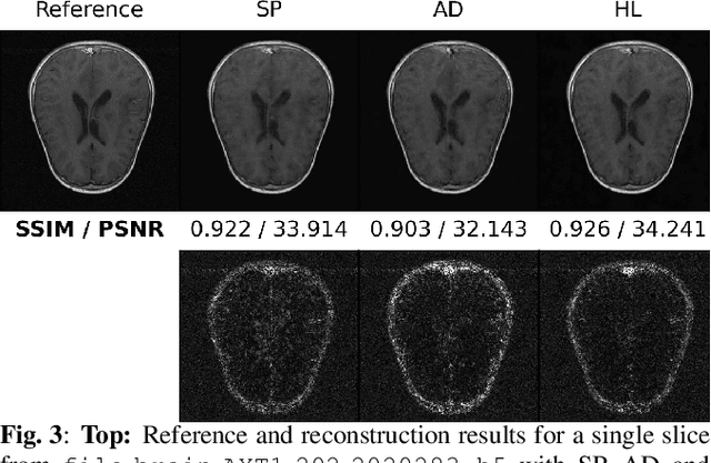 Figure 4 for Hybrid learning of Non-Cartesian k-space trajectory and MR image reconstruction networks