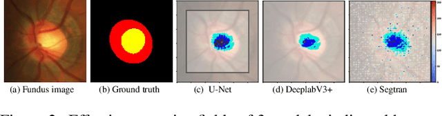 Figure 3 for Medical Image Segmentation Using Squeeze-and-Expansion Transformers