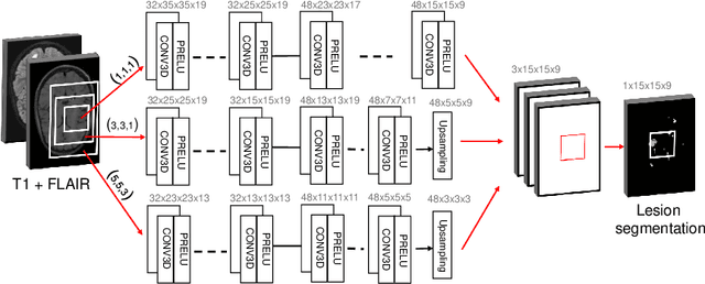 Figure 3 for Improved inter-scanner MS lesion segmentation by adversarial training on longitudinal data