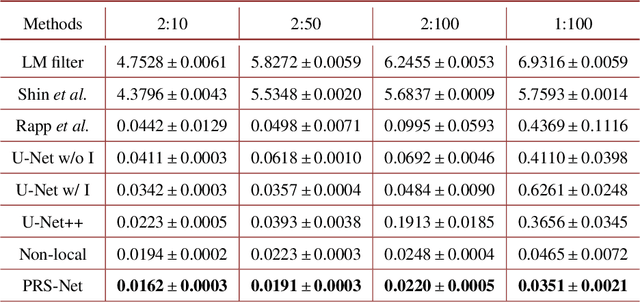 Figure 4 for Robust photon-efficient imaging using a pixel-wise residual shrinkage network