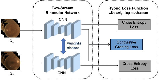 Figure 2 for Two Eyes Are Better Than One: Exploiting Binocular Correlation for Diabetic Retinopathy Severity Grading
