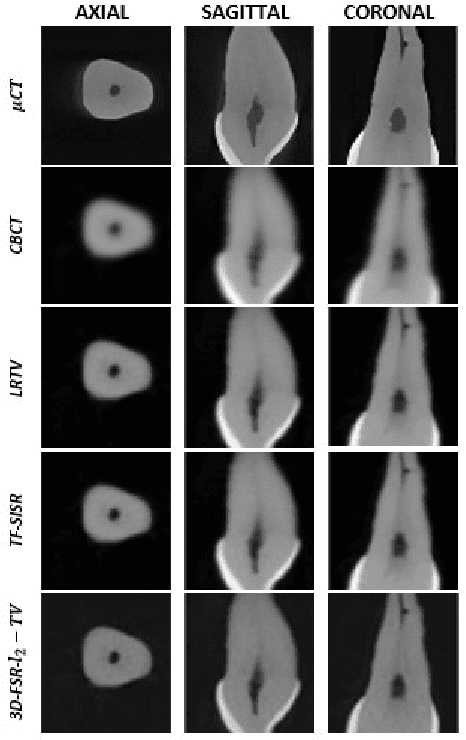 Figure 2 for A Novel Fast 3D Single Image Super-Resolution Algorithm