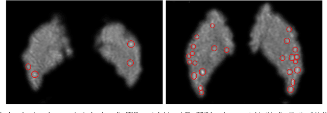Figure 1 for 3D Regression Neural Network for the Quantification of Enlarged Perivascular Spaces in Brain MRI