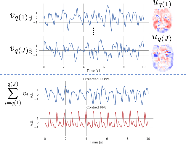 Figure 3 for Non-contact photoplethysmogram and instantaneous heart rate estimation from infrared face video