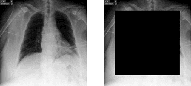 Figure 2 for Predictive Modeling in the Presence of Nuisance-Induced Spurious Correlations
