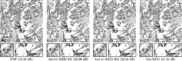 Figure 4 for Async-RED: A Provably Convergent Asynchronous Block Parallel Stochastic Method using Deep Denoising Priors