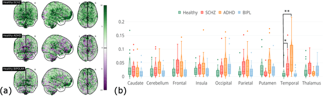 Figure 4 for Neural Processes Mixed-Effect Models for Deep Normative Modeling of Clinical Neuroimaging Data