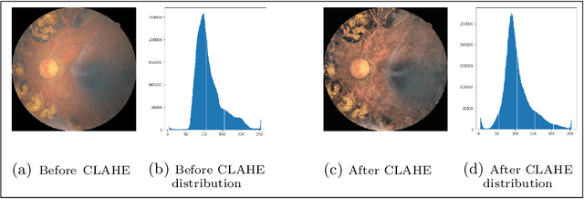 Figure 3 for Towards the Localisation of Lesions in Diabetic Retinopathy