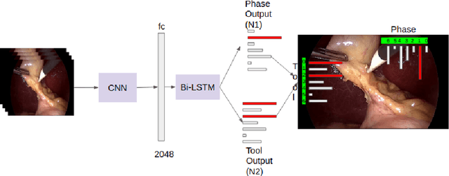 Figure 1 for Multitask Learning of Temporal Connectionism in Convolutional Networks using a Joint Distribution Loss Function to Simultaneously Identify Tools and Phase in Surgical Videos