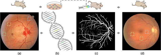 Figure 1 for Pathological Evidence Exploration in Deep Retinal Image Diagnosis