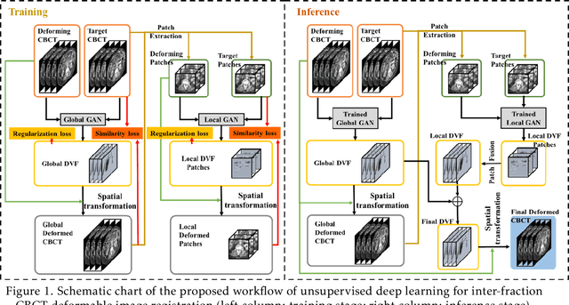 Figure 1 for Deformable Image Registration using Unsupervised Deep Learning for CBCT-guided Abdominal Radiotherapy