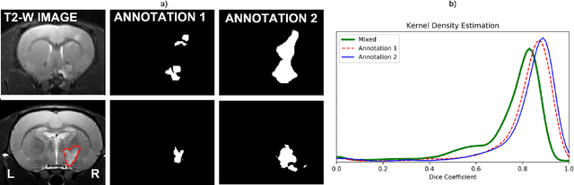 Figure 4 for RatLesNetv2: A Fully Convolutional Network for Rodent Brain Lesion Segmentation
