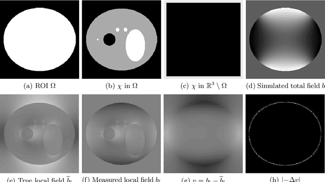 Figure 3 for Whole Brain Susceptibility Mapping Using Harmonic Incompatibility Removal