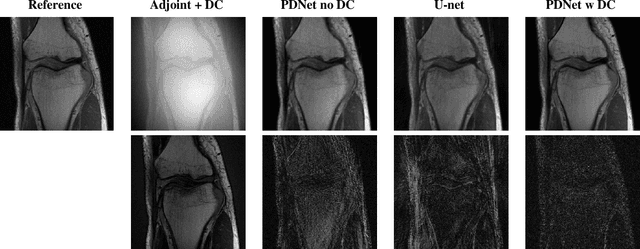 Figure 4 for Density Compensated Unrolled Networks for Non-Cartesian MRI Reconstruction