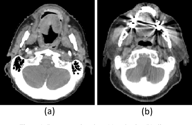 Figure 1 for Kernel Wasserstein Distance