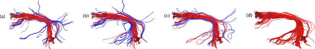 Figure 2 for Comparison of Distances for Supervised Segmentation of White Matter Tractography