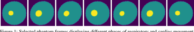 Figure 1 for Nonlinear motion separation via untrained generator networks with disentangled latent space variables and applications to cardiac MRI