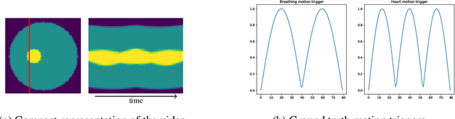 Figure 3 for Nonlinear motion separation via untrained generator networks with disentangled latent space variables and applications to cardiac MRI