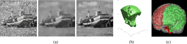 Figure 2 for Modern Convex Optimization to Medical Image Analysis