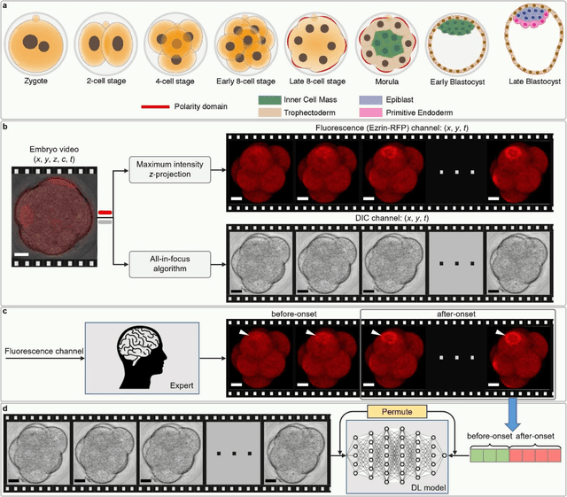 Figure 1 for Stain-free Detection of Embryo Polarization using Deep Learning