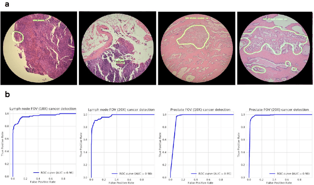Figure 3 for Microscope 2.0: An Augmented Reality Microscope with Real-time Artificial Intelligence Integration