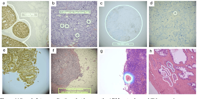 Figure 4 for Microscope 2.0: An Augmented Reality Microscope with Real-time Artificial Intelligence Integration