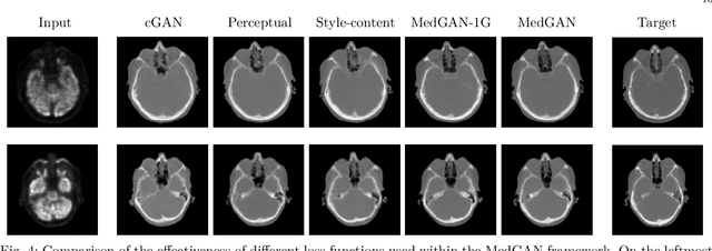 Figure 4 for MedGAN: Medical Image Translation using GANs