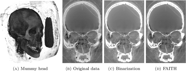Figure 2 for Feature-Adaptive Interactive Thresholding of Large 3D Volumes