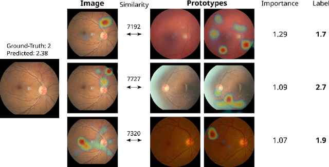Figure 3 for INSightR-Net: Interpretable Neural Network for Regression using Similarity-based Comparisons to Prototypical Examples