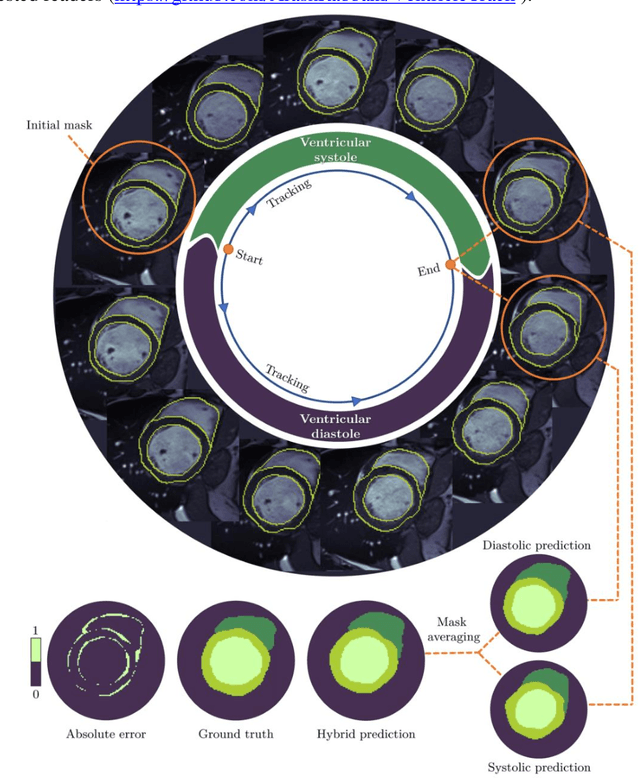 Figure 2 for Temporal extrapolation of heart wall segmentation in cardiac magnetic resonance images via pixel tracking