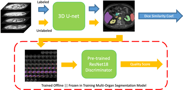 Figure 1 for Semi-Supervised Multi-Organ Segmentation through Quality Assurance Supervision