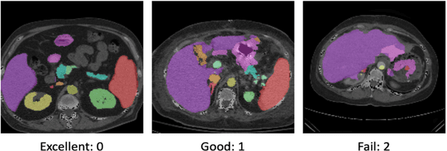 Figure 2 for Semi-Supervised Multi-Organ Segmentation through Quality Assurance Supervision