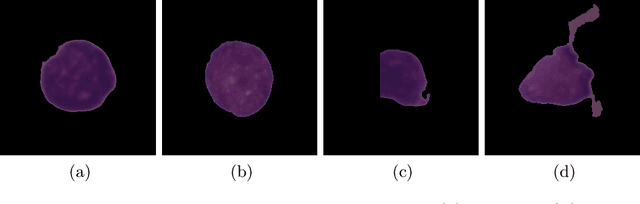 Figure 2 for Acute Lymphoblastic Leukemia Classification from Microscopic Images using Convolutional Neural Networks