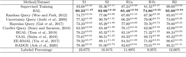 Figure 2 for Active Learning to Classify Macromolecular Structures in situ for Less Supervision in Cryo-Electron Tomography