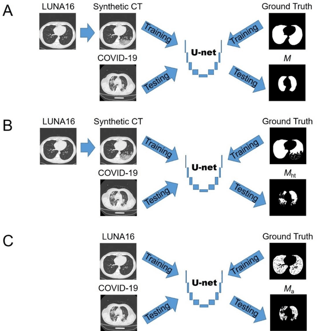 Figure 2 for Automated assessment of disease severity of COVID-19 using artificial intelligence with synthetic chest CT