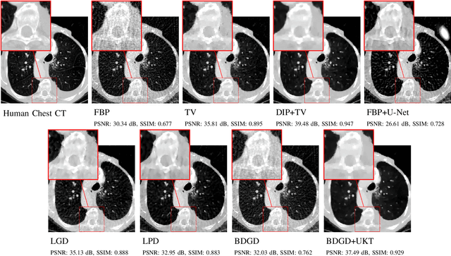 Figure 4 for Unsupervised Knowledge-Transfer for Learned Image Reconstruction