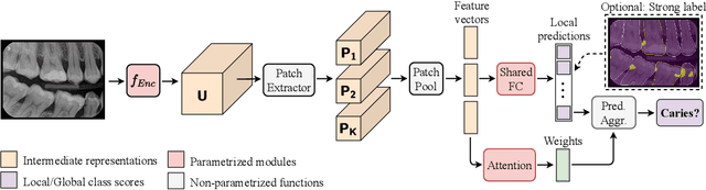 Figure 1 for Interpretable and Interactive Deep Multiple Instance Learning for Dental Caries Classification in Bitewing X-rays