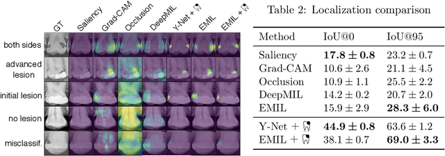 Figure 4 for Interpretable and Interactive Deep Multiple Instance Learning for Dental Caries Classification in Bitewing X-rays