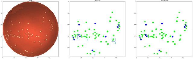 Figure 2 for Deep Learning to Detect Bacterial Colonies for the Production of Vaccines