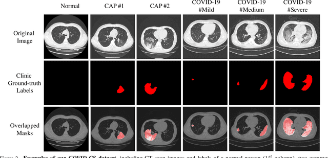 Figure 3 for JCS: An Explainable COVID-19 Diagnosis System by Joint Classification and Segmentation