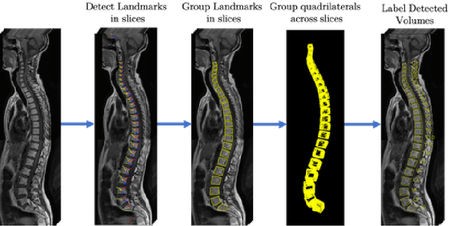 Figure 2 for A Convolutional Approach to Vertebrae Detection and Labelling in Whole Spine MRI