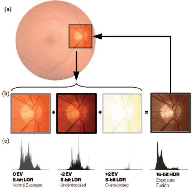 Figure 3 for Embedded deep learning in ophthalmology: Making ophthalmic imaging smarter