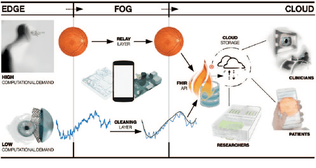 Figure 4 for Embedded deep learning in ophthalmology: Making ophthalmic imaging smarter
