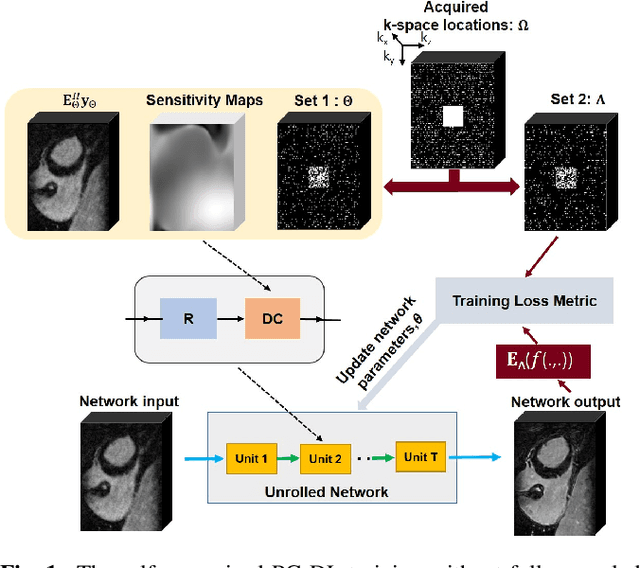 Figure 1 for Self-Supervised Physics-Guided Deep Learning Reconstruction For High-Resolution 3D LGE CMR