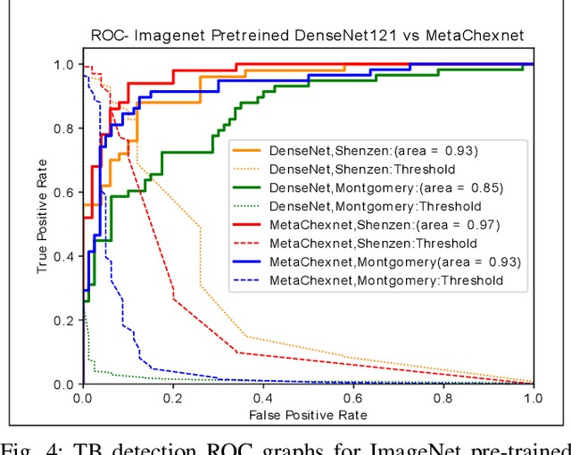 Figure 4 for Deep Feature Learning from a Hospital-Scale Chest X-ray Dataset with Application to TB Detection on a Small-Scale Dataset