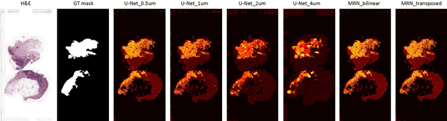 Figure 4 for Multi-Resolution Networks for Semantic Segmentation in Whole Slide Images