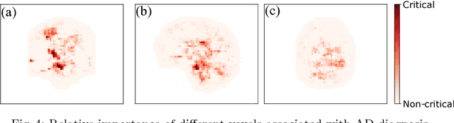 Figure 4 for End-To-End Alzheimer's Disease Diagnosis and Biomarker Identification
