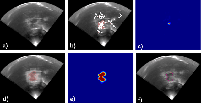 Figure 2 for Hough-CNN: Deep Learning for Segmentation of Deep Brain Regions in MRI and Ultrasound