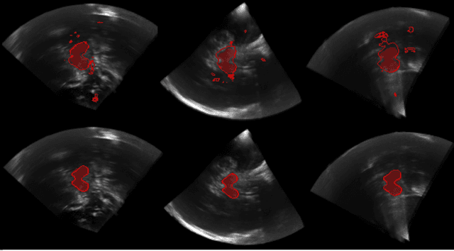 Figure 3 for Hough-CNN: Deep Learning for Segmentation of Deep Brain Regions in MRI and Ultrasound