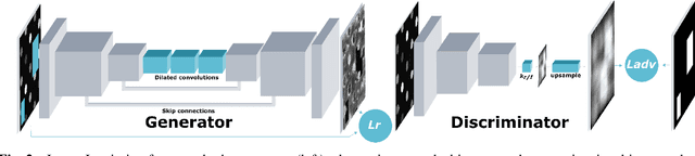 Figure 3 for Where is the Fake? Patch-Wise Supervised GANs for Texture Inpainting